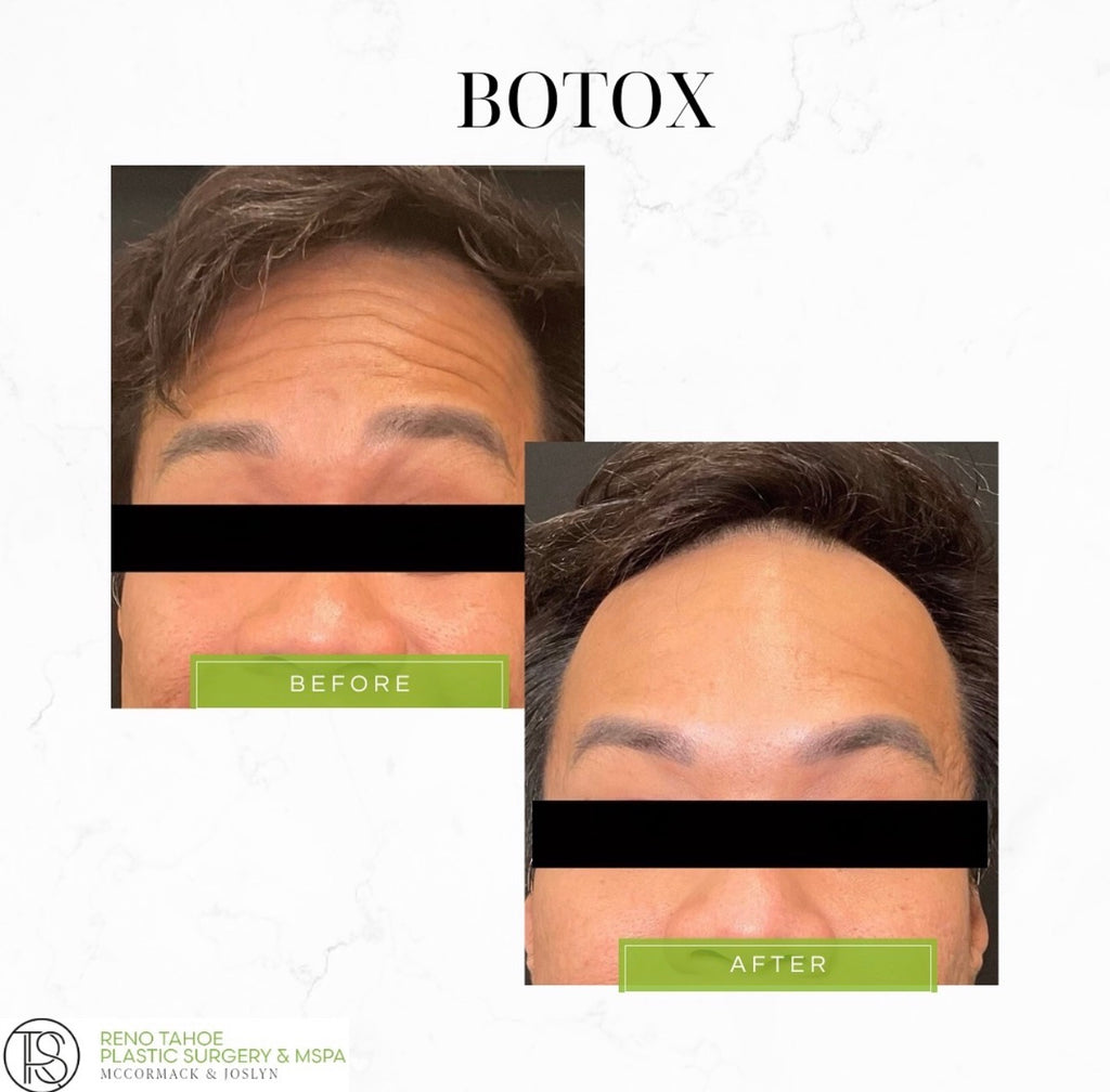 Day 6 | Neuromod Monday