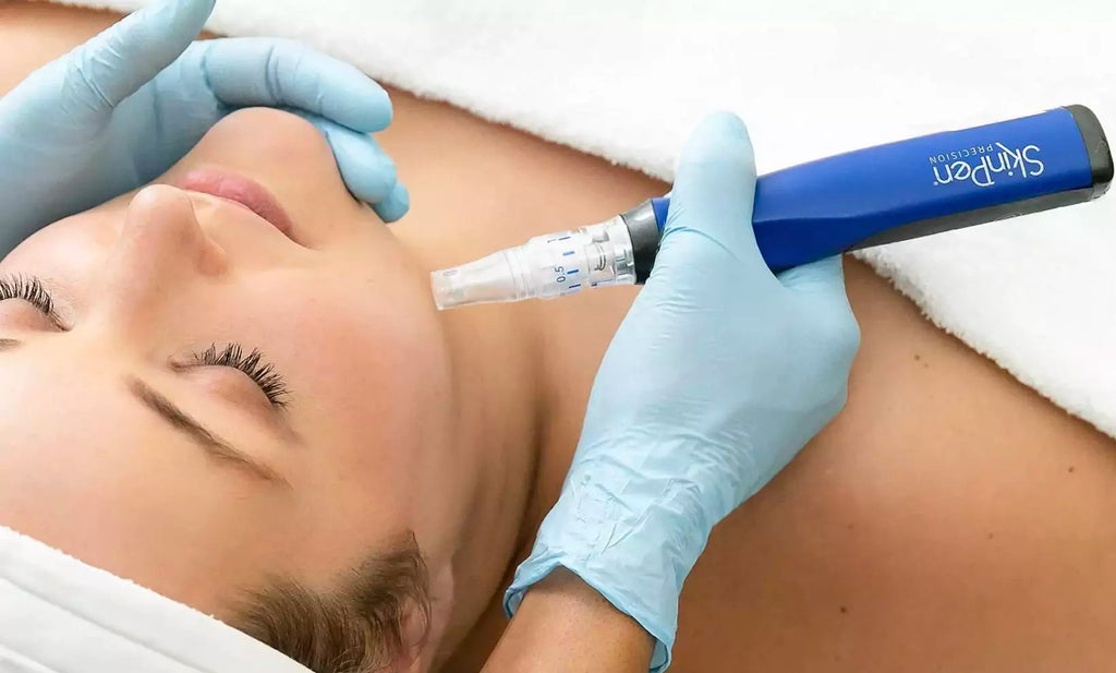 Day 10 | SkinPen Glow-Up